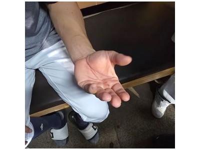 두산 베어스 선수 손가락 장애로 수술 거부해 팬들 분노