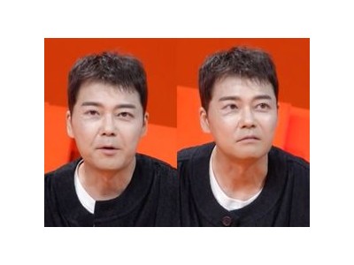 전현무 얼굴 상처로 방송 출연해 화제